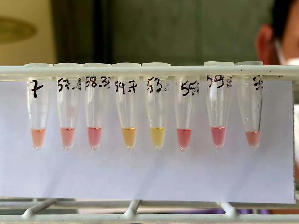 Pesquisadora da UFSM cria teste rápido para tuberculose